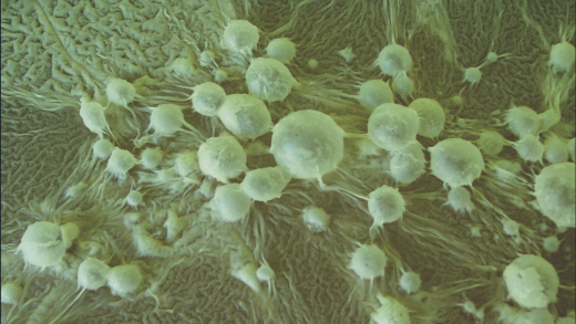 Collezione Microbica