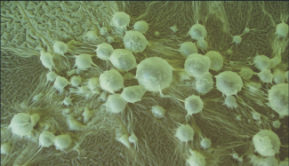 Collezione Microbica